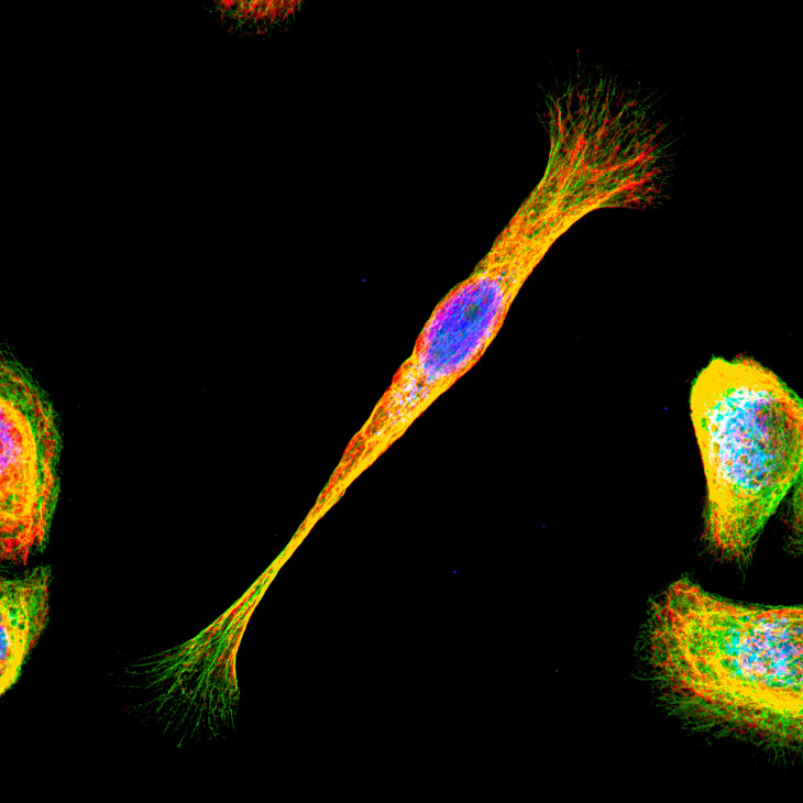 „Cells on the Move"
Foto: Hereon/Yan Nie On the Move_Helmholtz Imaging